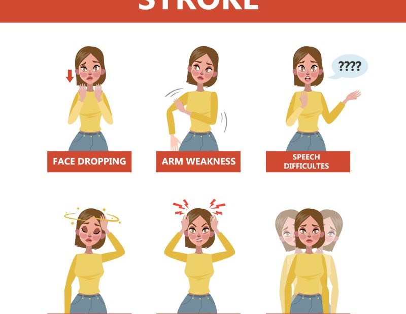 stroke